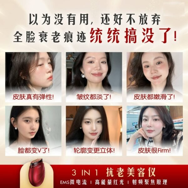 CEUDERM-CD-417-V2-3IN1-RF-EMS-RED-LIGHT-SWIFT-LIFT-BEAUTY-ENHANCEMENT-DEVICE1.jpg CEUDERM CD-417 (V2) 3IN1 (RF, EMS, RED LIGHT) SWIFT LIFT BEAUTY ENHANCEMENT DEVICE